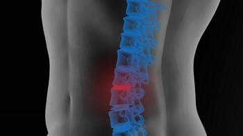 Treatment for Spanaway back pain after car accident in WA near 98387