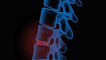 Experienced Fircrest local chiropractors in WA near 98466