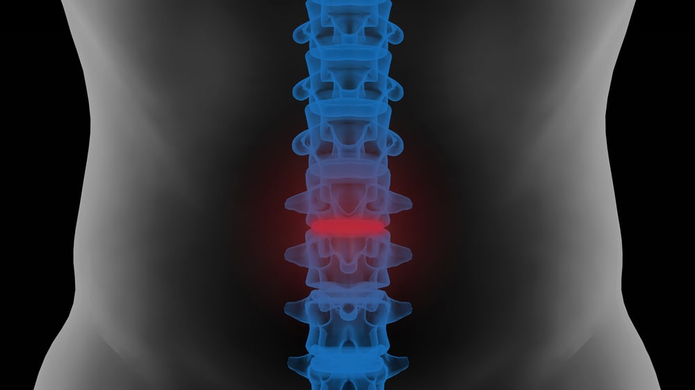 Lower-Back-Pain-Lakewood-WA